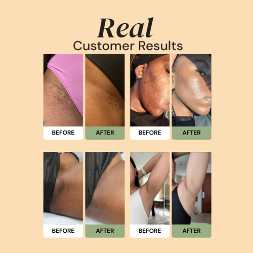 Alorin's Turmeric & Kojic Acid Soap