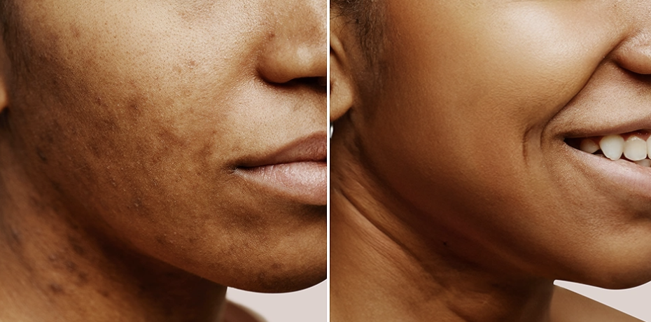 Not just "brightening" -